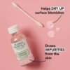 Mario Badescu Drying Lotion, 1 Fl oz, Dry Up Surface Blemishes Overnight