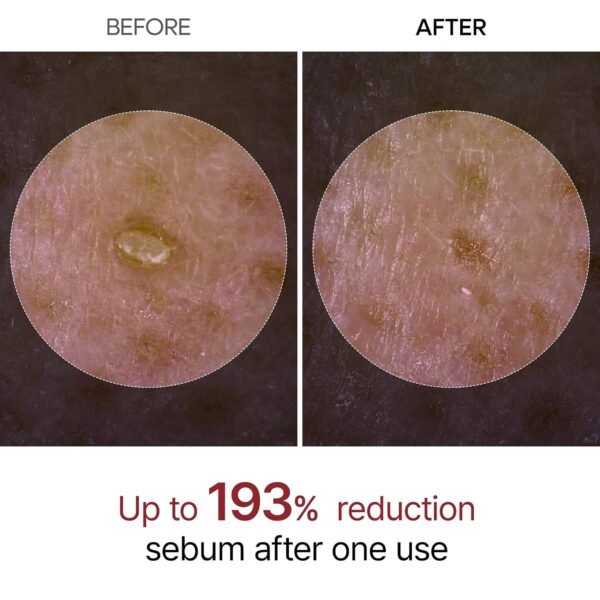 Dr.Melaxin Peel Shot Glow Rice Peeling Ampoule 80ml Daily Soft Exfoliating Face and Body Scrub Dead Skin Cells Blackhead Remover for All Skin Types korean skin care