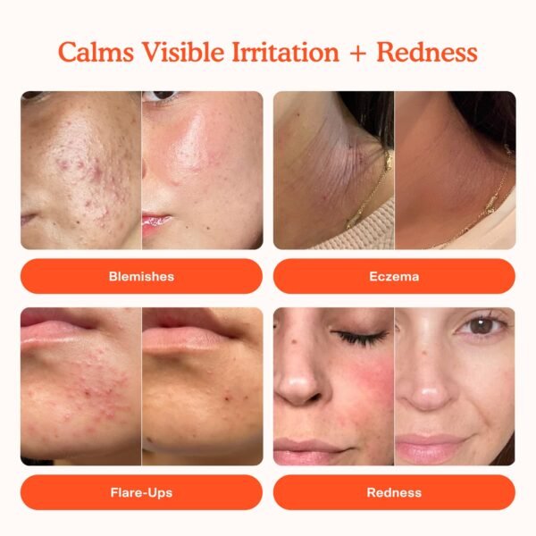 Tower 28 SOS Daily Rescue Facial Spray for Sensitive Skin, Hypochlorous Acid Spray Helps Reduce Redness and Breakouts, Full Size Toner for Face, 4 FL Oz