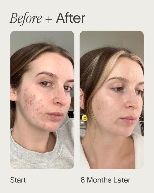 Topicals Faded Brightening and Clearing Serum | Reduces Discoloration, Scars, and Spots | Contains Kojic Acid and Niacinamide |Dermatologist-tested, Cruelty-Free (0.5 Fl Oz)